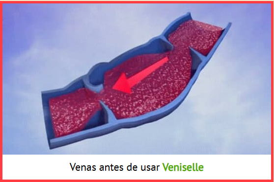 vaniselle antes