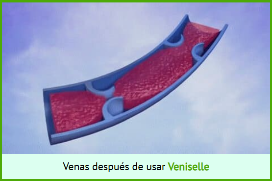 vaniselle despues